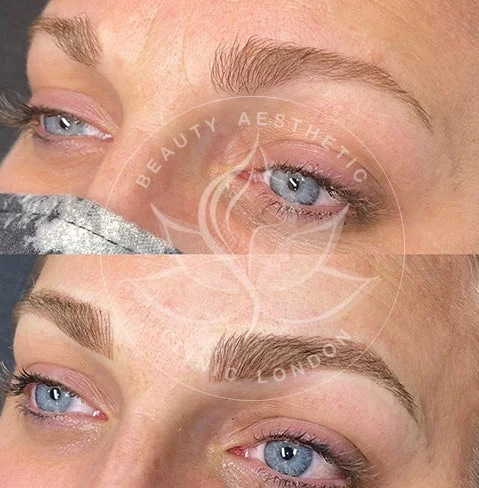 Detailed view of microblading eyebrows, highlighting the natural-looking, perfectly shaped brow strokes created with precision