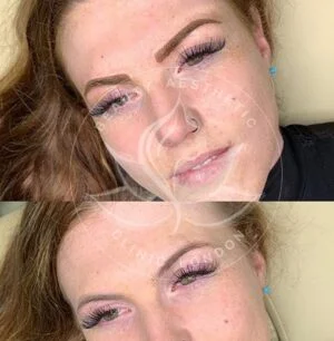 Detailed view of microblading eyebrows, highlighting the natural-looking, perfectly shaped brow strokes created with precision