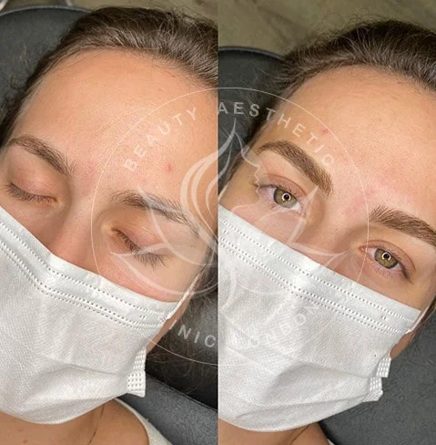 Detailed view of microblading eyebrows, highlighting the natural-looking, perfectly shaped brow strokes created with precision
