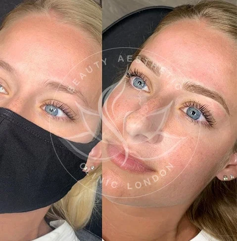 Detailed view of microblading eyebrows, highlighting the natural-looking, perfectly shaped brow strokes created with precision