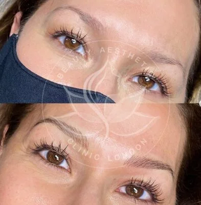 Detailed view of microblading eyebrows, highlighting the natural-looking, perfectly shaped brow strokes created with precision