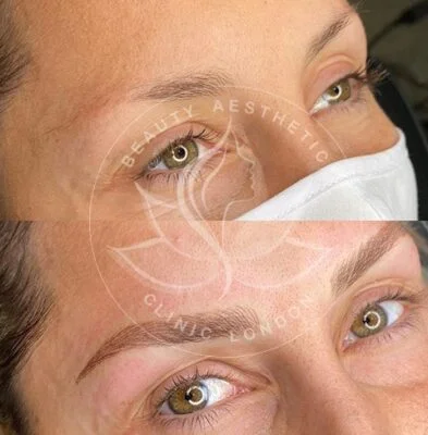 Detailed view of microblading eyebrows, highlighting the natural-looking, perfectly shaped brow strokes created with precision