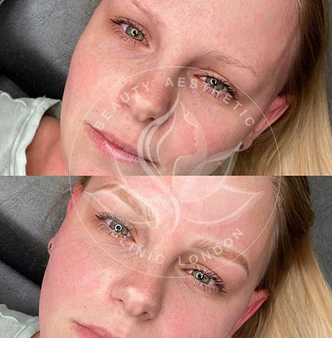 Detailed view of microblading eyebrows, highlighting the natural-looking, perfectly shaped brow strokes created with precision