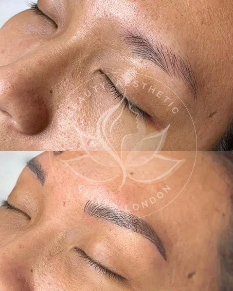 Detailed view of microblading eyebrows, highlighting the natural-looking, perfectly shaped brow strokes created with precision