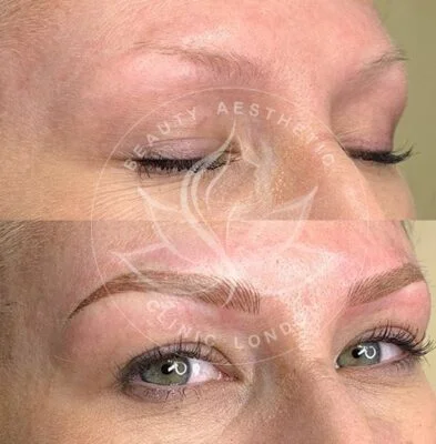 Detailed view of microblading eyebrows, highlighting the natural-looking, perfectly shaped brow strokes created with precision