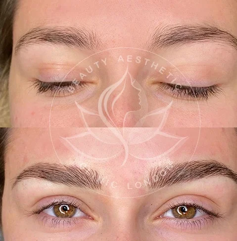 Detailed view of microblading eyebrows, highlighting the natural-looking, perfectly shaped brow strokes created with precision