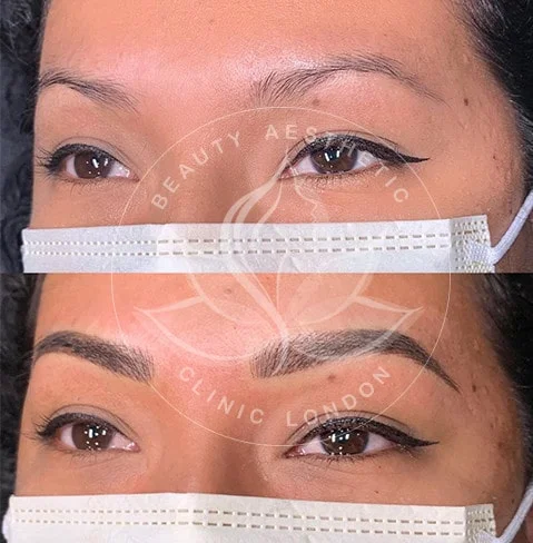 Detailed view of microblading eyebrows, highlighting the natural-looking, perfectly shaped brow strokes created with precision
