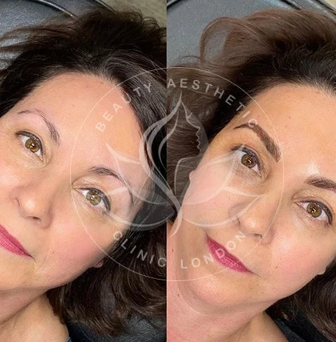 Detailed view of microblading eyebrows, highlighting the natural-looking, perfectly shaped brow strokes created with precision