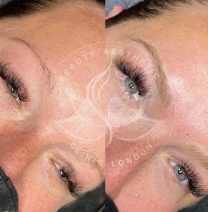 Detailed view of microblading eyebrows, highlighting the natural-looking, perfectly shaped brow strokes created with precision