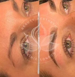 Detailed view of microblading eyebrows, highlighting the natural-looking, perfectly shaped brow strokes created with precision