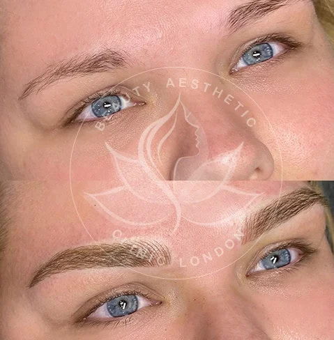 Detailed view of microblading eyebrows, highlighting the natural-looking, perfectly shaped brow strokes created with precision
