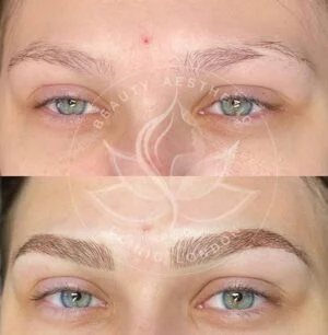 Detailed view of microblading eyebrows, highlighting the natural-looking, perfectly shaped brow strokes created with precision