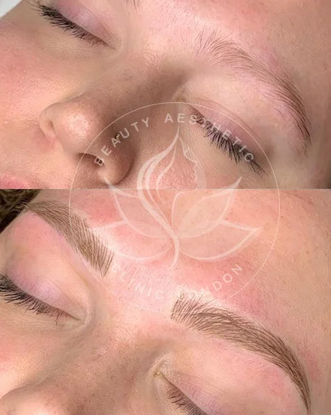 Detailed view of microblading eyebrows, highlighting the natural-looking, perfectly shaped brow strokes created with precision