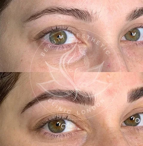 Detailed view of microblading eyebrows, highlighting the natural-looking, perfectly shaped brow strokes created with precision