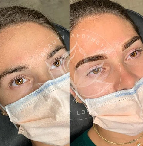 Detailed view of microblading eyebrows, highlighting the natural-looking, perfectly shaped brow strokes created with precision