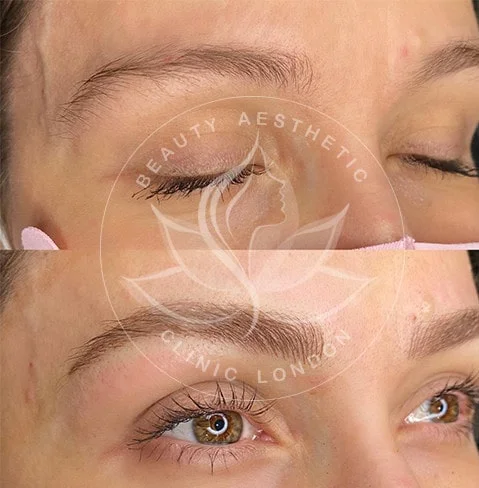 Detailed view of microblading eyebrows, highlighting the natural-looking, perfectly shaped brow strokes created with precision
