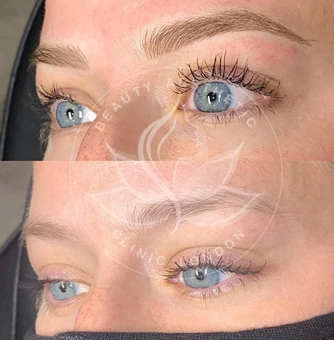 Detailed view of microblading eyebrows, highlighting the natural-looking, perfectly shaped brow strokes created with precision
