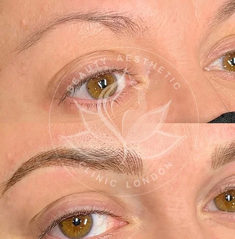 Detailed view of microblading eyebrows, highlighting the natural-looking, perfectly shaped brow strokes created with precision