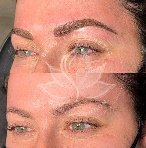 Detailed view of microblading eyebrows, highlighting the natural-looking, perfectly shaped brow strokes created with precision