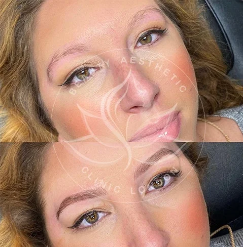 Detailed view of microblading eyebrows, highlighting the natural-looking, perfectly shaped brow strokes created with precision