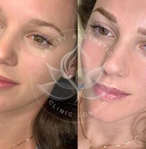 Detailed view of microblading eyebrows, highlighting the natural-looking, perfectly shaped brow strokes created with precision