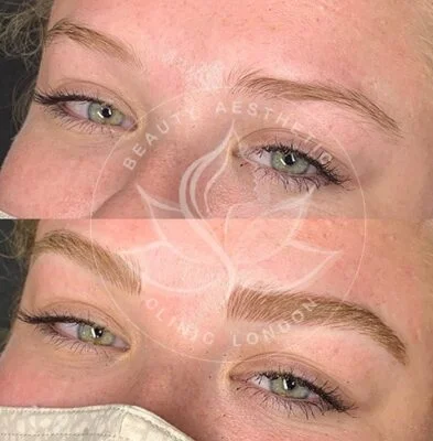 Detailed view of microblading eyebrows, highlighting the natural-looking, perfectly shaped brow strokes created with precision.