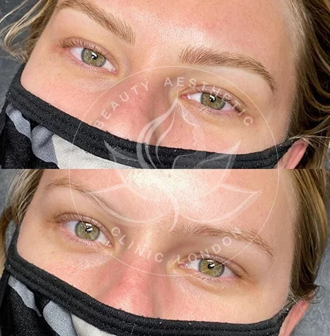 Detailed view of microblading eyebrows, highlighting the natural-looking, perfectly shaped brow strokes created with precision.