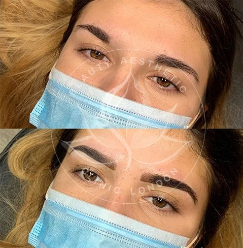 Detailed view of microblading eyebrows, highlighting the natural-looking, perfectly shaped brow strokes created with precision.