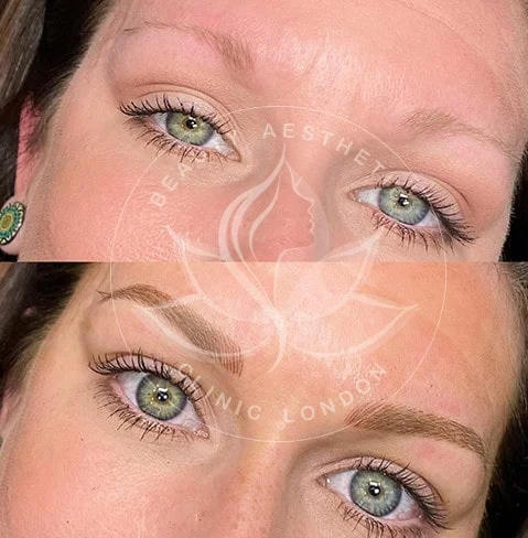Detailed view of microblading eyebrows, highlighting the natural-looking, perfectly shaped brow strokes created with precision.