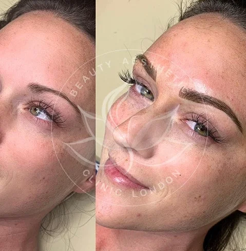 Detailed view of microblading eyebrows, highlighting the natural-looking, perfectly shaped brow strokes created with precision.