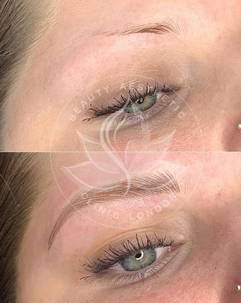 Detailed view of microblading eyebrows, highlighting the natural-looking, perfectly shaped brow strokes created with precision.