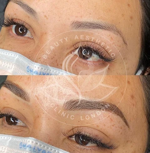 Detailed view of microblading eyebrows, highlighting the natural-looking, perfectly shaped brow strokes created with precision.