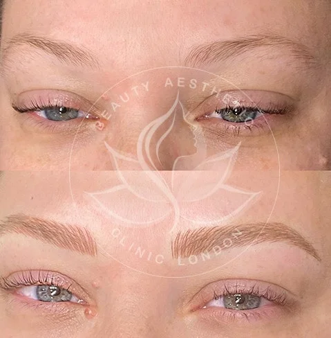 Detailed view of microblading eyebrows, highlighting the natural-looking, perfectly shaped brow strokes created with precision.