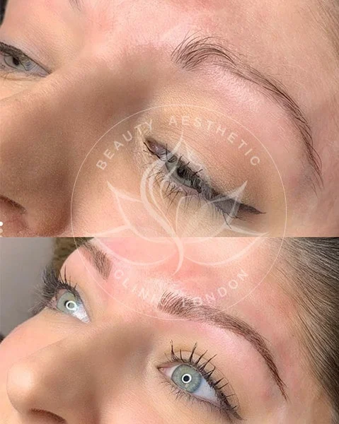 Detailed view of microblading eyebrows, highlighting the natural-looking, perfectly shaped brow strokes created with precision.