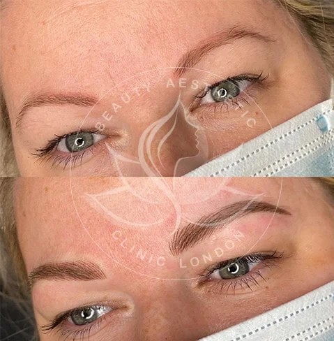Detailed view of microblading eyebrows, highlighting the natural-looking, perfectly shaped brow strokes created with precision