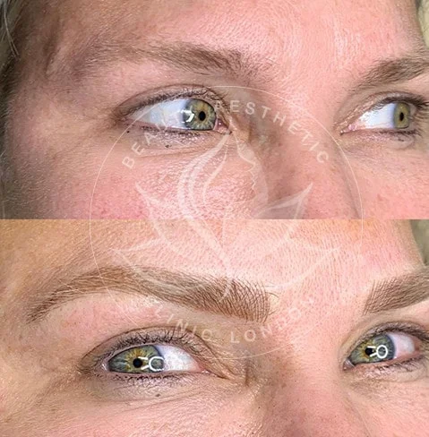 Detailed view of microblading eyebrows, highlighting the natural-looking, perfectly shaped brow strokes created with precision.