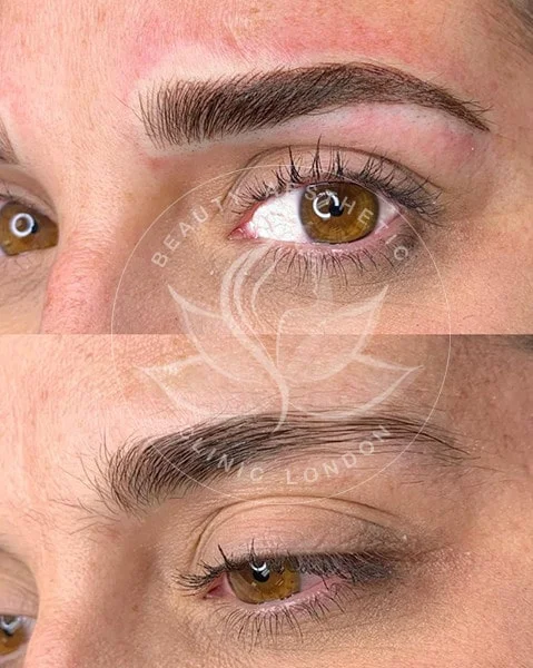 Detailed view of microblading eyebrows, highlighting the natural-looking, perfectly shaped brow strokes created with precision.