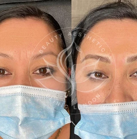 Detailed view of microblading eyebrows, highlighting the natural-looking, perfectly shaped brow strokes created with precision.