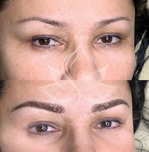 Detailed view of microblading eyebrows, highlighting the natural-looking, perfectly shaped brow strokes created with precision.