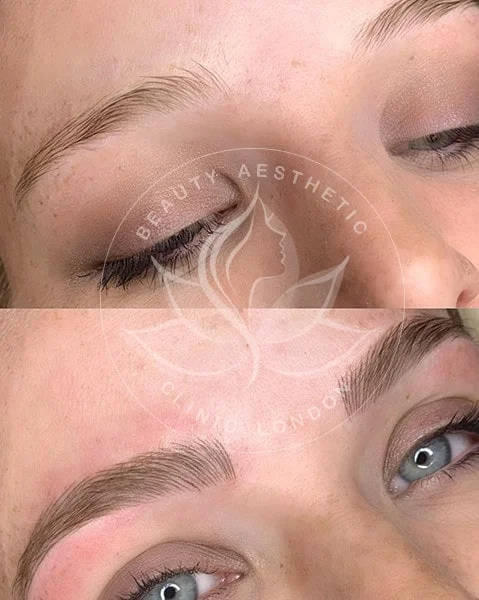 Detailed view of microblading eyebrows, highlighting the natural-looking, perfectly shaped brow strokes created with precision.