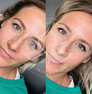 Detailed view of microblading eyebrows, highlighting the natural-looking, perfectly shaped brow strokes created with precision.