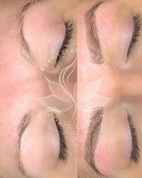 Detailed view of microblading eyebrows, highlighting the natural-looking, perfectly shaped brow strokes created with precision