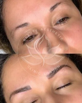 Detailed view of microblading eyebrows, highlighting the natural-looking, perfectly shaped brow strokes created with precision.