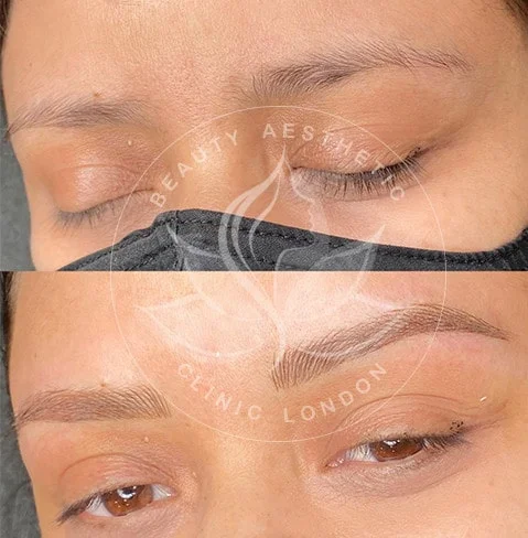 Detailed view of microblading eyebrows, highlighting the natural-looking, perfectly shaped brow strokes created with precision