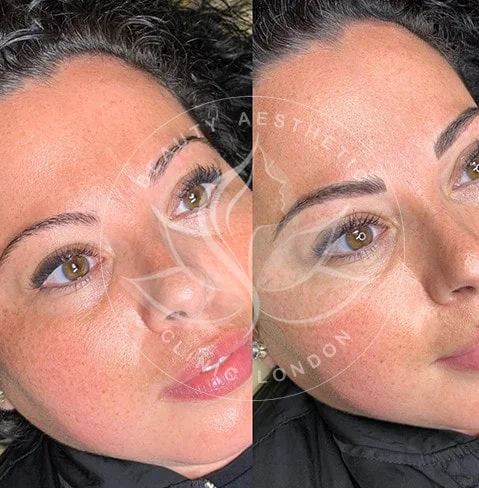 Detailed view of microblading eyebrows, highlighting the natural-looking, perfectly shaped brow strokes created with precision.