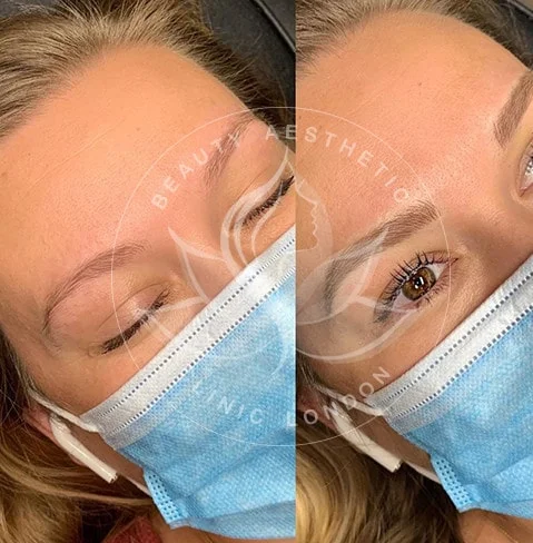 Detailed view of microblading eyebrows, highlighting the natural-looking, perfectly shaped brow strokes created with precision.