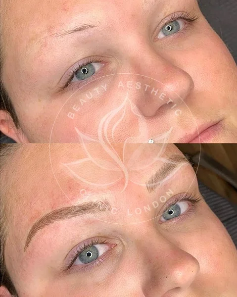 Detailed view of microblading eyebrows, highlighting the natural-looking, perfectly shaped brow strokes created with precision