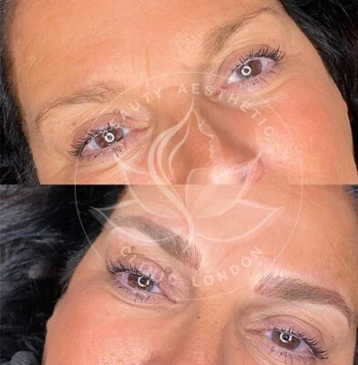 Detailed view of microblading eyebrows, highlighting the natural-looking, perfectly shaped brow strokes created with precision.