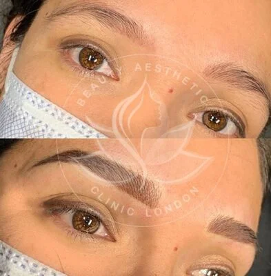 Detailed view of microblading eyebrows, highlighting the natural-looking, perfectly shaped brow strokes created with precision