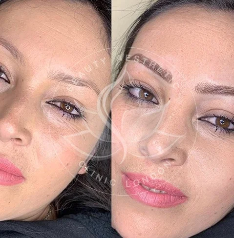 Detailed view of microblading eyebrows, highlighting the natural-looking, perfectly shaped brow strokes created with precision